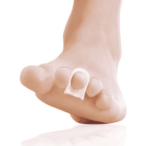 Deramed Hammer Toe Straightener Ring