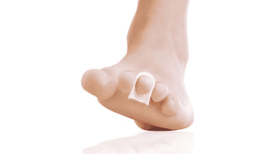 Deramed Hammer Toe Straightener Ring